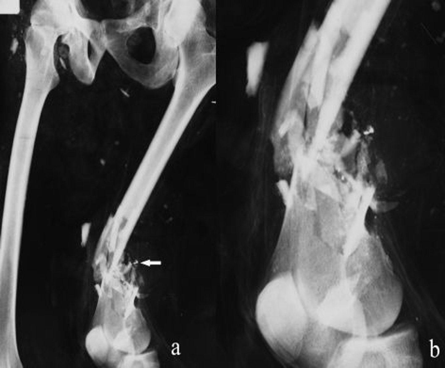 <p>fracture in which the bone is splintered or crushed</p>