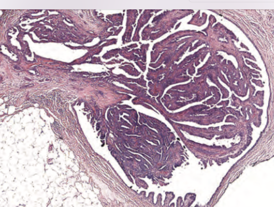 <p>diagnostico </p>