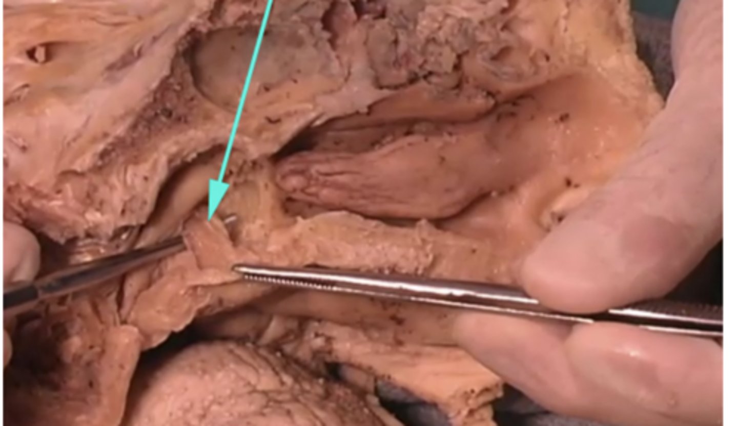 <p>What is the name of the structure as specified by the arrow?</p><p>-subcutaneous fascia</p><p>-pectoralis major</p><p>-levator veli palatini</p><p>-levator scapulae</p>