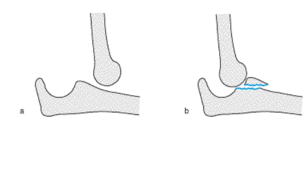 <p>Ellenbogenluxation</p>