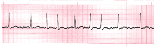 <p>what is this heart rhythm? </p>