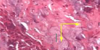 <p>identify</p>