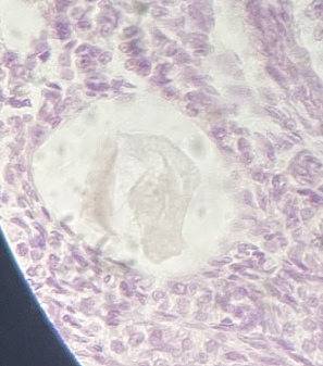 <p>stage of development and maturation</p>