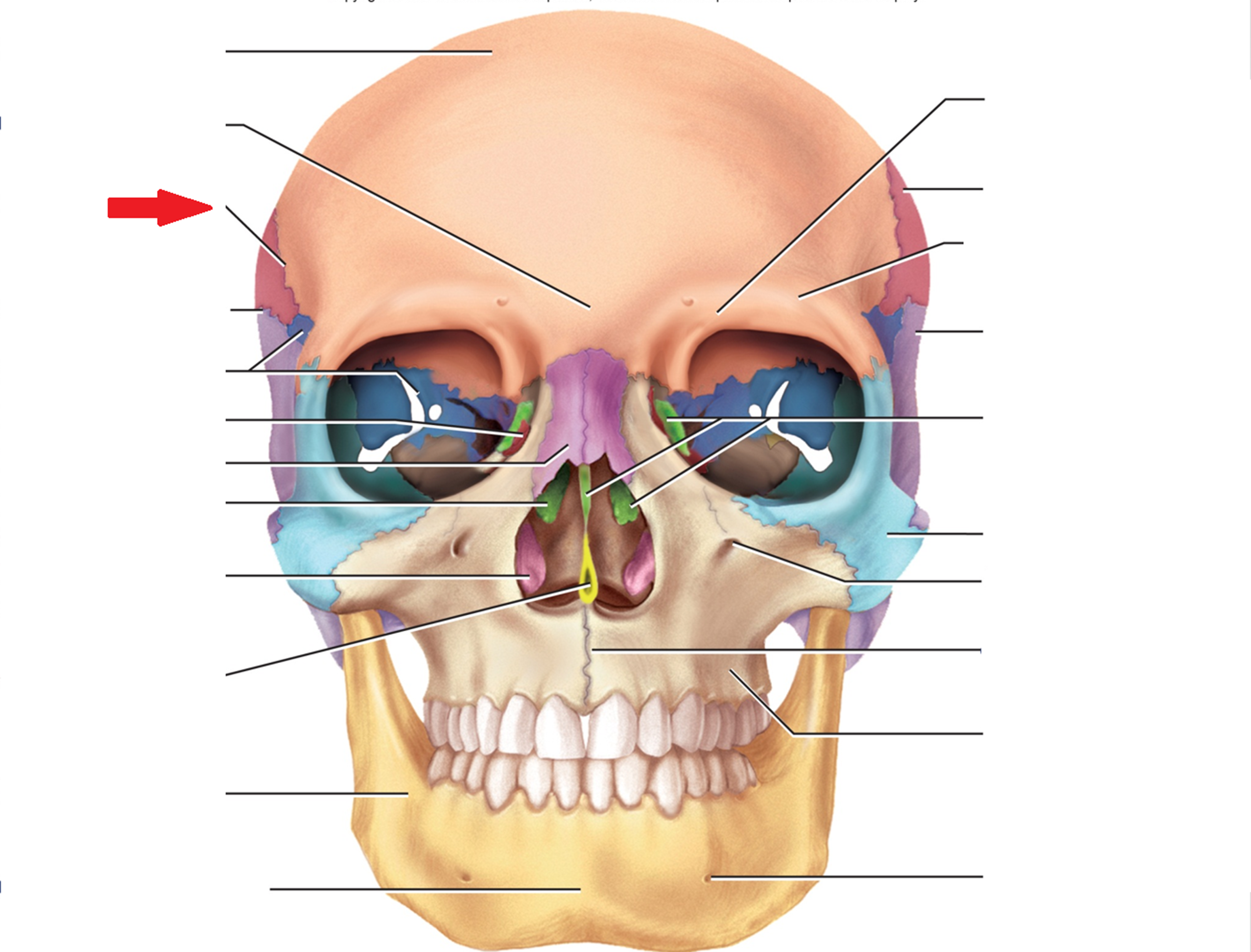 term image