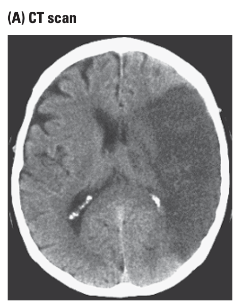 computer tomography (CT)