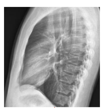 <p>Identify the structure ? View?</p>