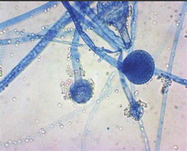<p>Microscopically, you can see the spores and hyphae. </p>