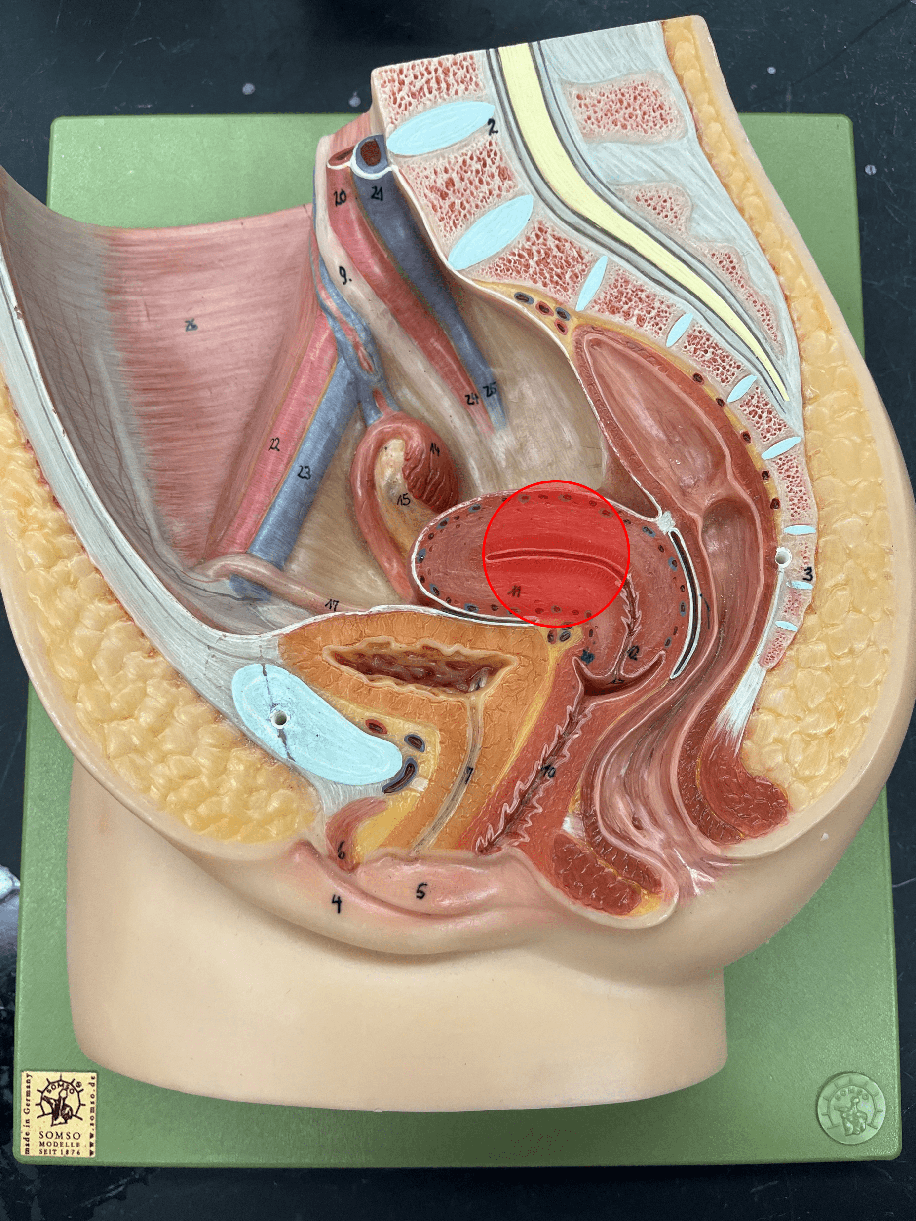 • A pear-shaped organ supporting development of new life.

• Posterior to the bladder and anterior to the rectum.

• Divided into the fundus, body, and cervix.