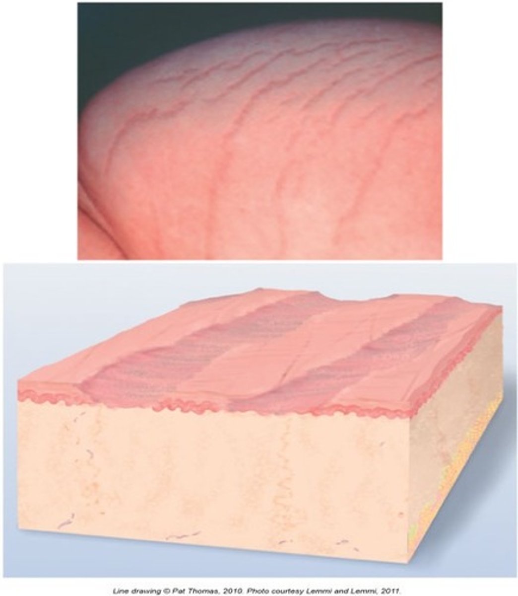 <p>After a skin lesion is repaired, normal tissue is lost and replaced with connective tissue (collagen). Examples: healed area of surgery or injury, acne.</p>