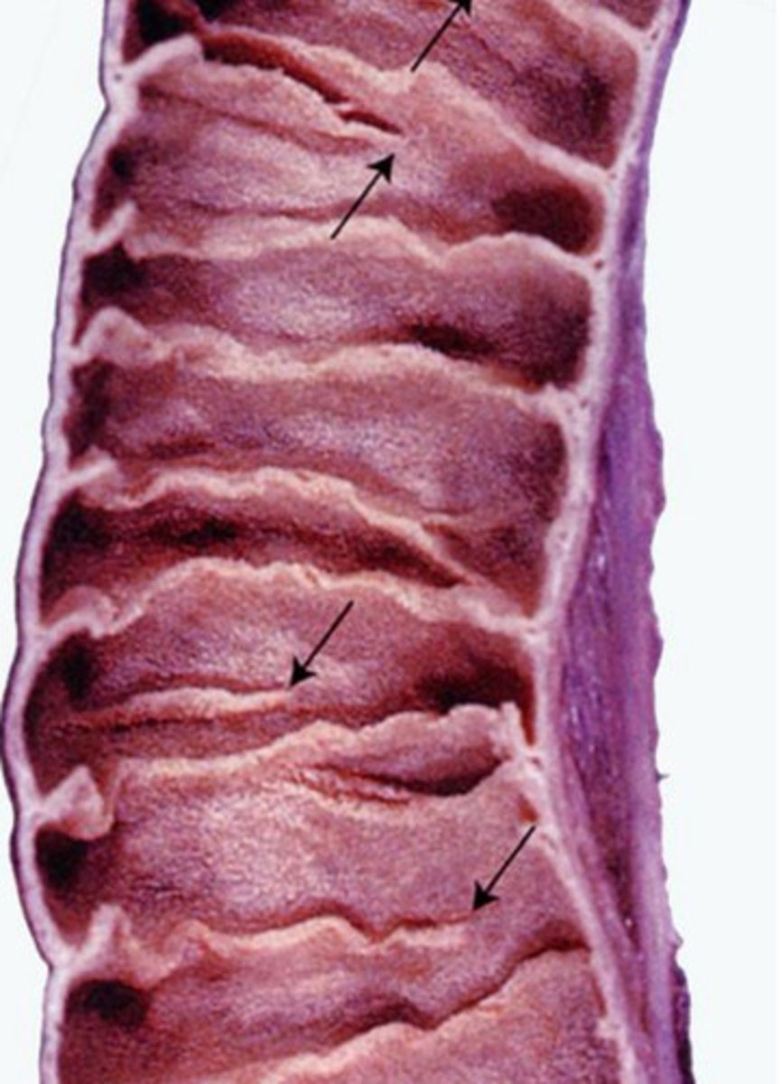 <p>plicae circulares</p><p>- infolding of submucosa</p>