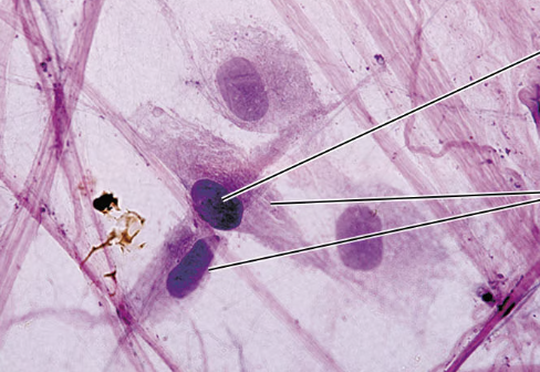 <p>what type of connective tissue cell is seen in this picture?</p>