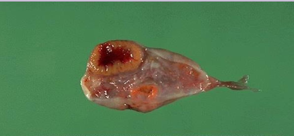 <p>Corpus luteum</p>