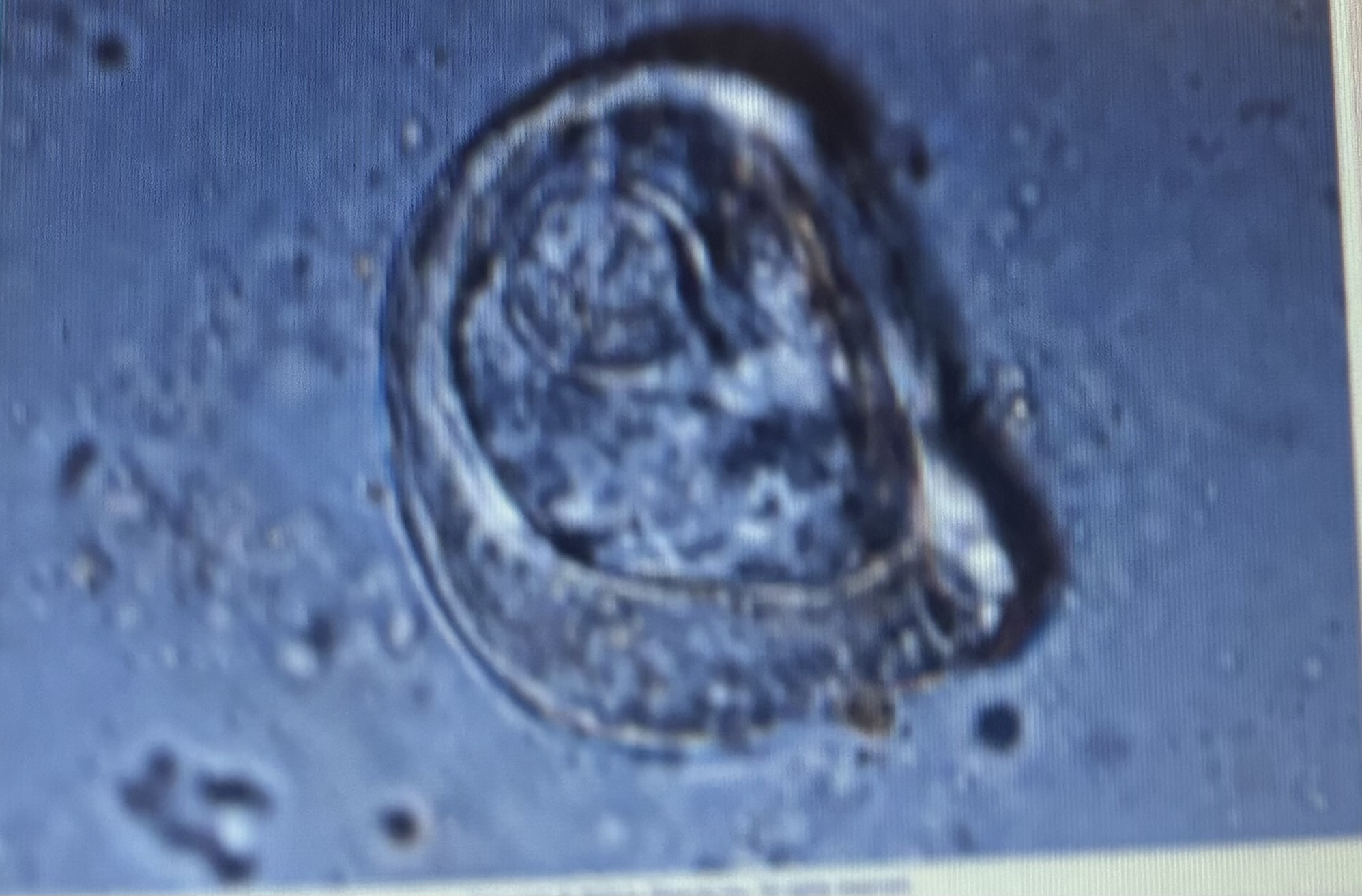 <p>Host species horse</p><p>Size 65-80 um</p>