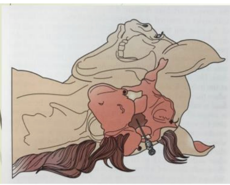 <p>Site of Cerebrospinal Puncture</p><ul><li><p><span style="background-color: transparent; font-family: "Times New Roman", serif;"><span>Anesthetized horse</span></span></p></li></ul><ul><li><p><span style="background-color: transparent; font-family: "Times New Roman", serif;"><span>Higher up</span></span></p></li><li><p><span style="background-color: transparent; font-family: "Times New Roman", serif;"><span>Where spinal cord is leaving the skull</span></span></p></li><li><p><span style="background-color: transparent; font-family: "Times New Roman", serif;"><span>Above foramen magnum</span></span></p></li><li><p><span style="background-color: transparent; font-family: "Times New Roman", serif;"><span>Riskier</span></span></p></li></ul><p></p>