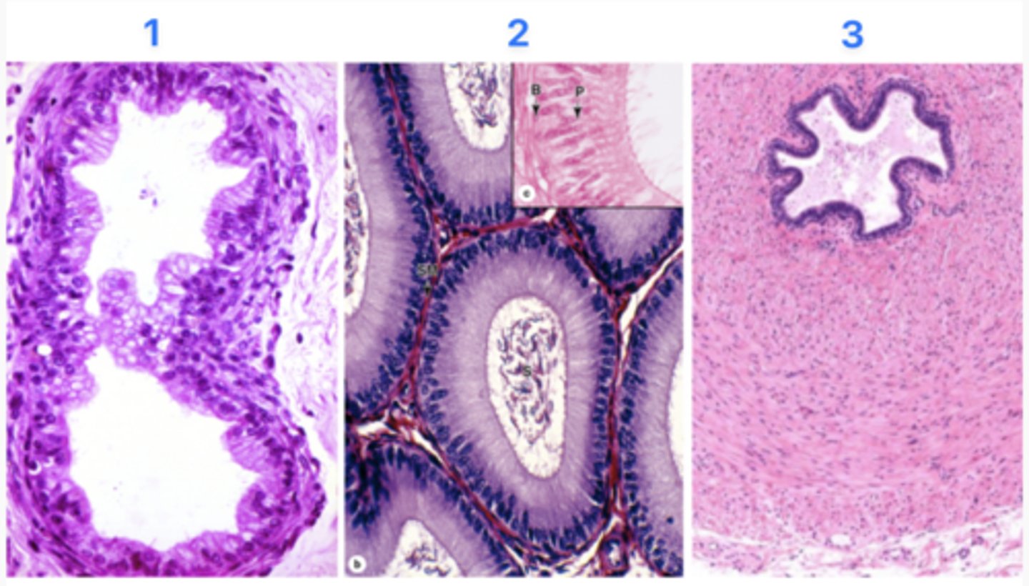 <p>Which site does sperm maturation (moving forward) occur in?</p>