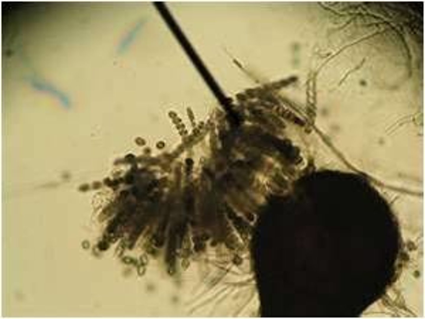 <p>Flask-shaped perithecium. Each Clump Is an ascus Each Containing 8 ascospores</p>