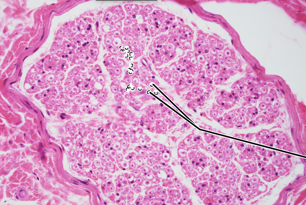 <p>peripheral nerve</p><p><span>tiny purple puncta or dots in the image</span></p>