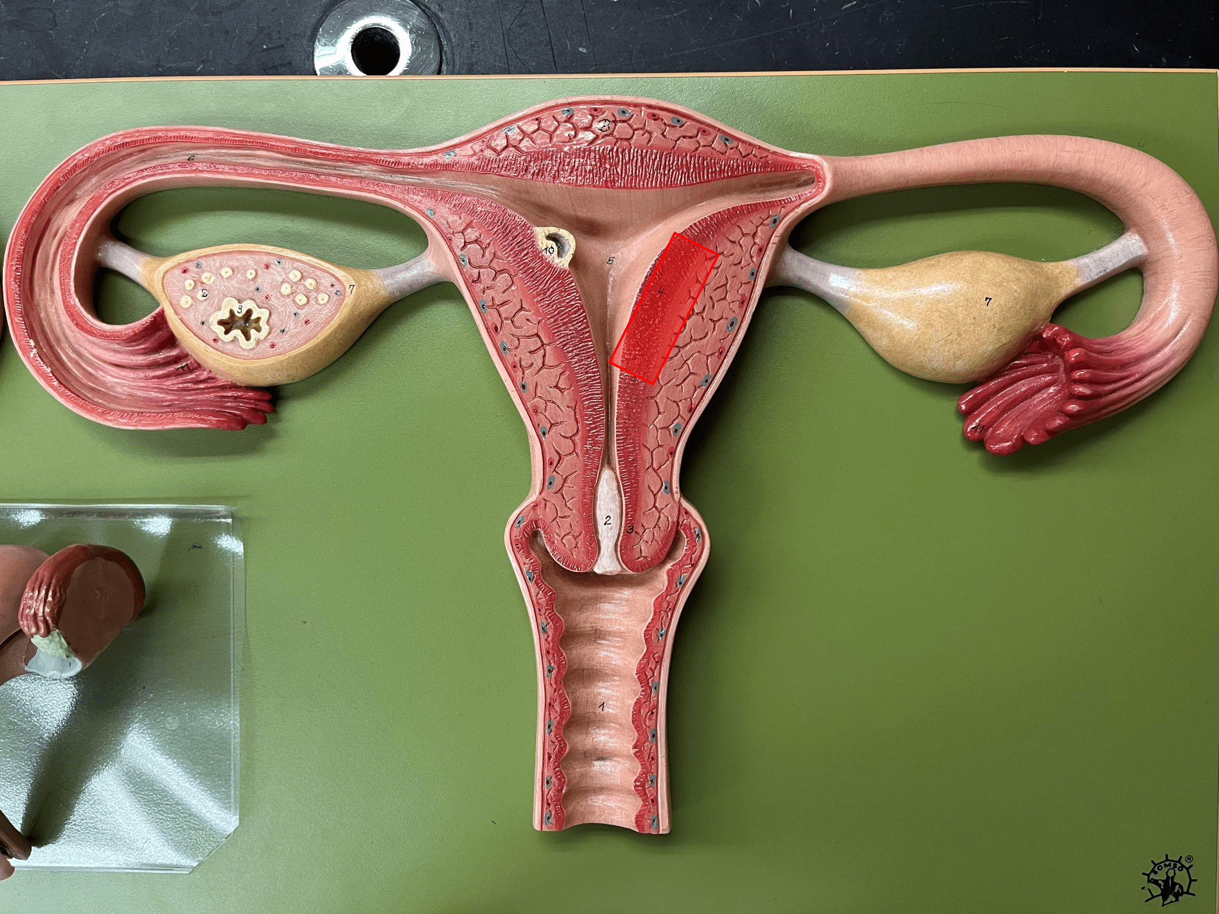 • Part of the wall of the uterus.

• The innermost layer.

• Undergoes monthly changes in preparation of conception.