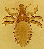 <p>What Parasite Is This?</p>