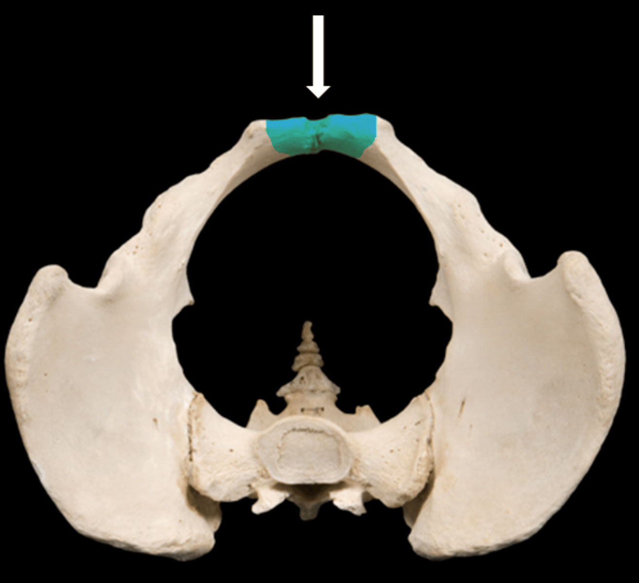 <p>name the part</p>