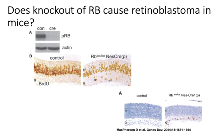 <p>Does knockout of RB cause retinoblastoma in mice?</p><p>—nesprin eye prom—cre——————-lox-Rb-lox—</p>