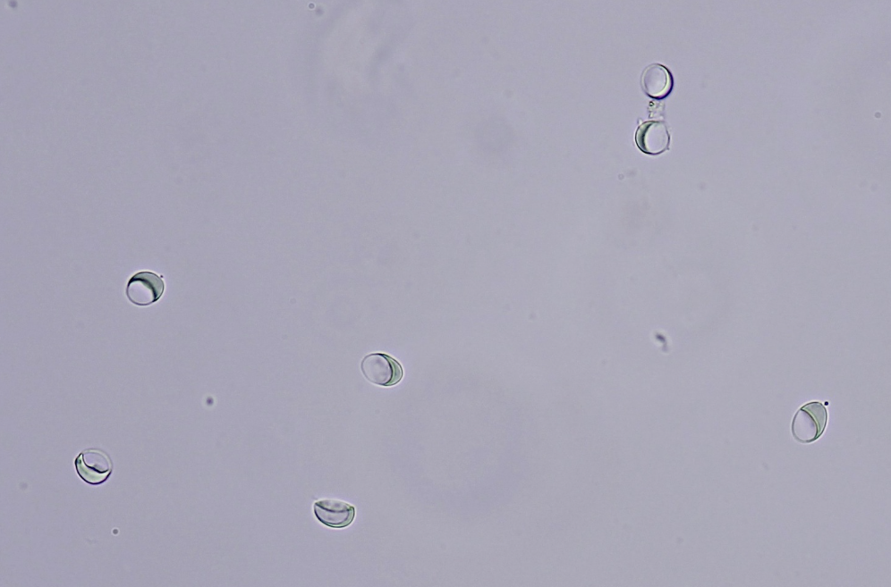 <p><strong>Giardia spp</strong>. - dogs, cats. (G. duodenalis, G. canis)</p><ul><li><p><strong>Trophozoite </strong>- flagellated, motile, pear-shaped stage, bilaterally symmetrical, convex dorsal side, concave ventral side with a large ventral suction disc, two nuclei, two medial axostyles, eight flagella, a pair of medial bodies, lacks mitochondria/golgi apparatus.</p></li><li><p><strong>Cysts </strong>- oval shape, 4 nuclei, fragments of medial bodies, decomposed suction disc, opalescent green color. (infectious stage). </p></li><li><p>In SI (esp. duodenum, jejunum)</p></li></ul><p>Flotation (faust solution)</p>