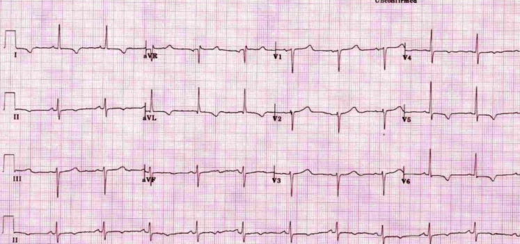 <p>what is this?</p>