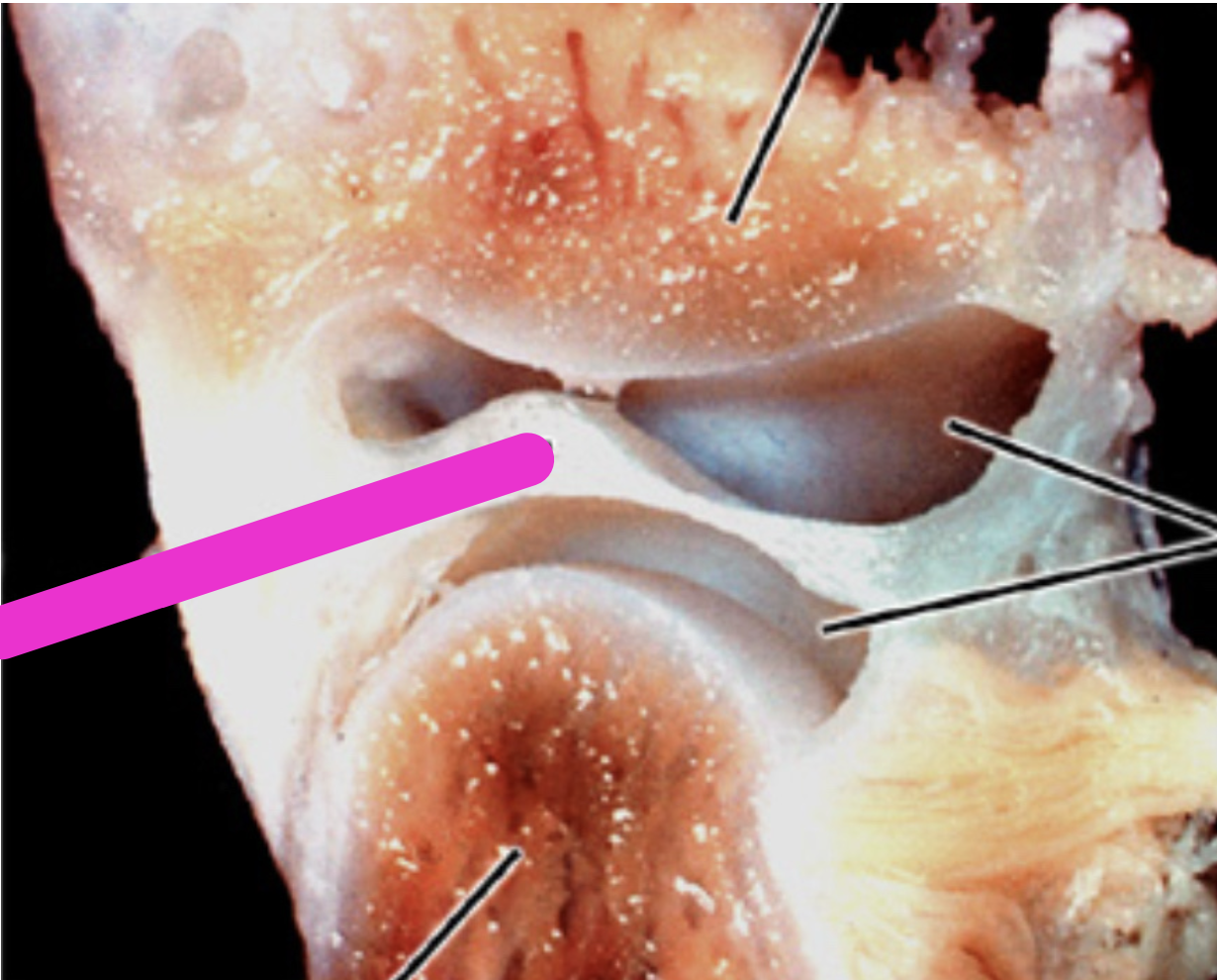 <p>Identify the structure</p>