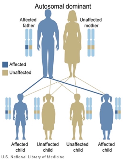 <ul><li><p>50% risk in offspring</p></li><li><p>Transmission by females and males and both are equally affected</p></li><li><p>Affected individuals have affected parent</p></li><li><p>Teds to occur in every generation</p></li></ul><p></p>