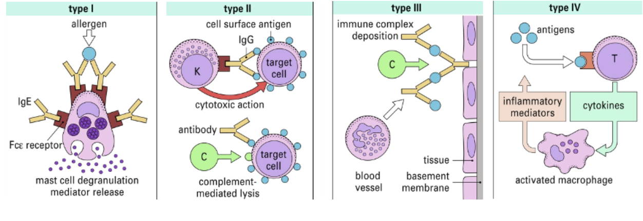 <table style="min-width: 50px;"><colgroup><col style="min-width: 25px;"><col style="min-width: 25px;"></colgroup><tbody><tr><td colspan="1" rowspan="1" style="border-width: 1pt; border-style: solid; padding: 5pt; overflow: hidden; overflow-wrap: break-word;"><p><span style="background-color: transparent;"><span>Pros</span></span></p></td><td colspan="1" rowspan="1" style="border-width: 1pt; border-style: solid; padding: 5pt; overflow: hidden; overflow-wrap: break-word;"><p><span style="background-color: transparent;"><span>Cons</span></span></p></td></tr><tr><td colspan="1" rowspan="1" style="border-width: 1pt; border-style: solid; padding: 5pt; overflow: hidden; overflow-wrap: break-word;"><p><span style="background-color: transparent;"><span>Only successful attempt to classify disease by mechanism</span></span></p><p><span style="background-color: transparent;"><span>Useful framework to describe and understand various diseases.</span></span></p></td><td colspan="1" rowspan="1" style="border-width: 1pt; border-style: solid; padding: 5pt; overflow: hidden; overflow-wrap: break-word;"><p><span style="background-color: transparent;"><span>Not useful clinically</span></span></p><p><span style="background-color: transparent;"><span>Oversimplified - many diseases (particularly chronic) utilise multiple components of the immune system and don't fit into this&nbsp;</span></span></p><p><span style="background-color: transparent;"><span>classification.</span></span></p></td></tr></tbody></table><p><strong><br></strong></p>