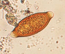 <p><strong><span>Trichuris AKA Whipworms</span></strong></p><p><strong><span>LI and in mucosa anteriorly&nbsp;</span></strong></p><p>Pis, dogs, ovine, cattle</p><p></p><p><span><span>-</span></span><span style="font-family: "Times New Roman"; line-height: normal; font-size: 7pt;"><span>&nbsp;&nbsp;&nbsp;&nbsp;&nbsp;&nbsp;&nbsp; </span></span>Detection</p><p class="MsoListParagraphCxSpMiddle"><span style="font-family: "Courier New";"><span>o</span></span><span style="font-family: "Times New Roman"; line-height: normal; font-size: 7pt;"><span>&nbsp;&nbsp; </span></span>ZnSO4 floatation (high gravity, don’t float easily)</p><p class="MsoListParagraphCxSpLast"><span style="font-family: "Courier New";"><span>o</span></span><span style="font-family: "Times New Roman"; line-height: normal; font-size: 7pt;"><span>&nbsp;&nbsp; </span></span>Sedimentation (direct method)</p><p class="MsoListParagraphCxSpLast"></p><p class="MsoListParagraphCxSpLast"><span><span>-</span></span><span style="font-family: "Times New Roman"; line-height: normal; font-size: 7pt;"><span>&nbsp;&nbsp;&nbsp;&nbsp;&nbsp;&nbsp;&nbsp; </span></span>Young animals high burden?</p><p class="MsoListParagraphCxSpMiddle"><span style="font-family: "Courier New";"><span>o</span></span><span style="font-family: "Times New Roman"; line-height: normal; font-size: 7pt;"><span>&nbsp;&nbsp; </span></span>Long PPT (3yo dog)</p><p class="MsoListParagraphCxSpMiddle"><span style="font-family: "Courier New";"><span>o</span></span><span style="font-family: "Times New Roman"; line-height: normal; font-size: 7pt;"><span>&nbsp;&nbsp; </span></span>Worms not eliciting sig protective immune response</p><p class="MsoListParagraphCxSpMiddle"></p><p class="MsoListParagraphCxSpMiddle"><span><span>-</span></span><span style="font-family: "Times New Roman"; line-height: normal; font-size: 7pt;"><span>&nbsp;&nbsp;&nbsp;&nbsp;&nbsp;&nbsp;&nbsp; </span></span>Why intermittent shedding</p><p class="MsoListParagraphCxSpMiddle"><span style="font-family: "Courier New";"><span>o</span></span><span style="font-family: "Times New Roman"; line-height: normal; font-size: 7pt;"><span>&nbsp;&nbsp; </span></span>F = intermittent egg producer, produce low # eggs/day</p><p class="MsoListParagraphCxSpMiddle"><span style="font-family: "Courier New";"><span>o</span></span><span style="font-family: "Times New Roman"; line-height: normal; font-size: 7pt;"><span>&nbsp;&nbsp; </span></span>Sample faeces over a few days</p><p class="MsoListParagraphCxSpMiddle"><span style="font-family: "Courier New";"><span>o</span></span><span style="font-family: "Times New Roman"; line-height: normal; font-size: 7pt;"><span>&nbsp;&nbsp; </span></span>Do not float in all floatation solutions</p><p class="MsoListParagraphCxSpMiddle"></p><p class="MsoListParagraphCxSpMiddle"><span><span>-</span></span><span style="font-family: "Times New Roman"; line-height: normal; font-size: 7pt;"><span>&nbsp;&nbsp;&nbsp;&nbsp;&nbsp;&nbsp;&nbsp; </span></span>Drug failure (pyrantel)</p><p class="MsoListParagraphCxSpMiddle"><span style="font-family: "Courier New";"><span>o</span></span><span style="font-family: "Times New Roman"; line-height: normal; font-size: 7pt;"><span>&nbsp;&nbsp; </span></span>Drug insensitive parasite</p><p class="MsoListParagraphCxSpMiddle"><span style="font-family: "Courier New";"><span>o</span></span><span style="font-family: "Times New Roman"; line-height: normal; font-size: 7pt;"><span>&nbsp;&nbsp; </span></span>Distant taxonomy to most nematodes (different subclass)</p><p class="MsoListParagraphCxSpMiddle"></p><p class="MsoListParagraphCxSpMiddle"><span><span>-</span></span><span style="font-family: "Times New Roman"; line-height: normal; font-size: 7pt;"><span>&nbsp;&nbsp;&nbsp;&nbsp;&nbsp;&nbsp;&nbsp; </span></span>Tx recommendation</p><p class="MsoListParagraphCxSpMiddle"><span style="font-family: "Courier New";"><span>o</span></span><span style="font-family: "Times New Roman"; line-height: normal; font-size: 7pt;"><span>&nbsp;&nbsp; </span></span>BZ – fenbendazole 3d consecutively</p><p class="MsoListParagraphCxSpMiddle"><span style="font-family: "Courier New";"><span>o</span></span><span style="font-family: "Times New Roman"; line-height: normal; font-size: 7pt;"><span>&nbsp;&nbsp; </span></span>Drontal – ML + febantel combined</p><p class="MsoListParagraphCxSpMiddle"><span style="font-family: "Courier New";"><span>o</span></span><span style="font-family: "Times New Roman"; line-height: normal; font-size: 7pt;"><span>&nbsp;&nbsp; </span></span>Repeat treatment monthly for 3months (resistant), reinfection likely</p><p class="MsoListParagraphCxSpMiddle"><span style="font-family: "Courier New";"><span>o</span></span><span style="font-family: "Times New Roman"; line-height: normal; font-size: 7pt;"><span>&nbsp;&nbsp; </span></span>Hygiene – remove faeces</p><p class="MsoListParagraphCxSpMiddle"><span><span>-</span></span><span style="font-family: "Times New Roman"; line-height: normal; font-size: 7pt;"><span>&nbsp;&nbsp;&nbsp;&nbsp;&nbsp;&nbsp;&nbsp; </span></span>Significance for humans</p><p class="MsoListParagraphCxSpLast"><span style="font-family: "Courier New";"><span>o</span></span><span style="font-family: "Times New Roman"; line-height: normal; font-size: 7pt;"><span>&nbsp;&nbsp; </span></span>Very rarely infects humans</p>