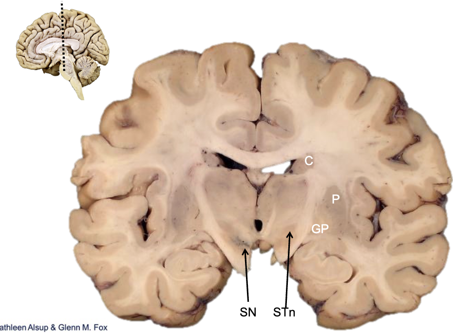<p><strong>what is SN?</strong></p>