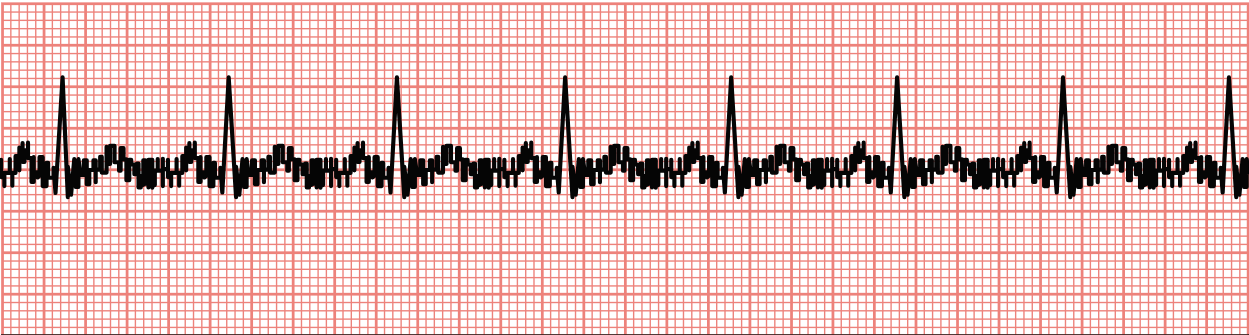 <p>Which type of artifact is shown in this image?</p>