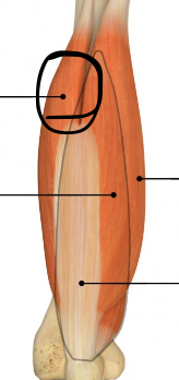 <p>triceps brachii m. (lateral)</p><p>O: posterior proximal humerus <br>I: Olecranon process of ulna<br>A: Extends elbow and adduction of humerus <br>N: Radial n.</p>