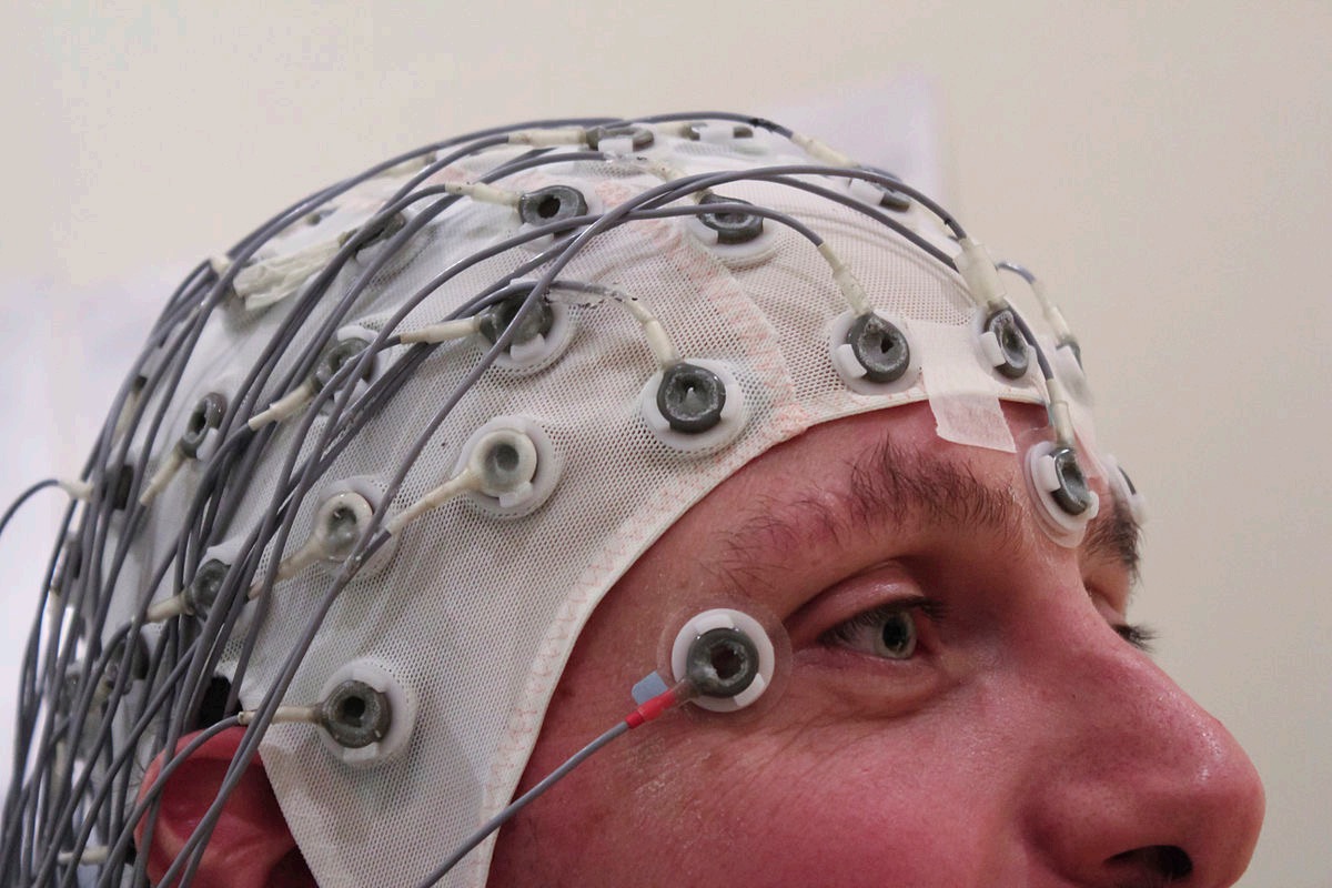 <p>Magnetoencephalography (MEG)</p>