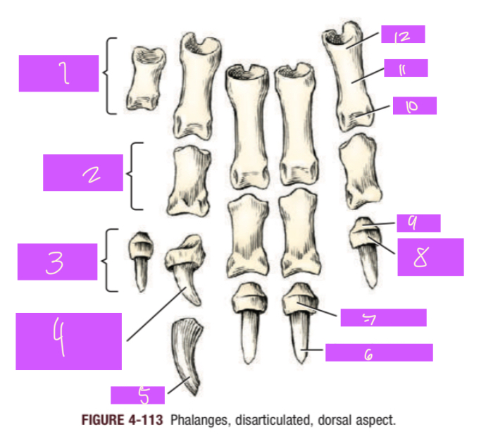 <p>11</p>