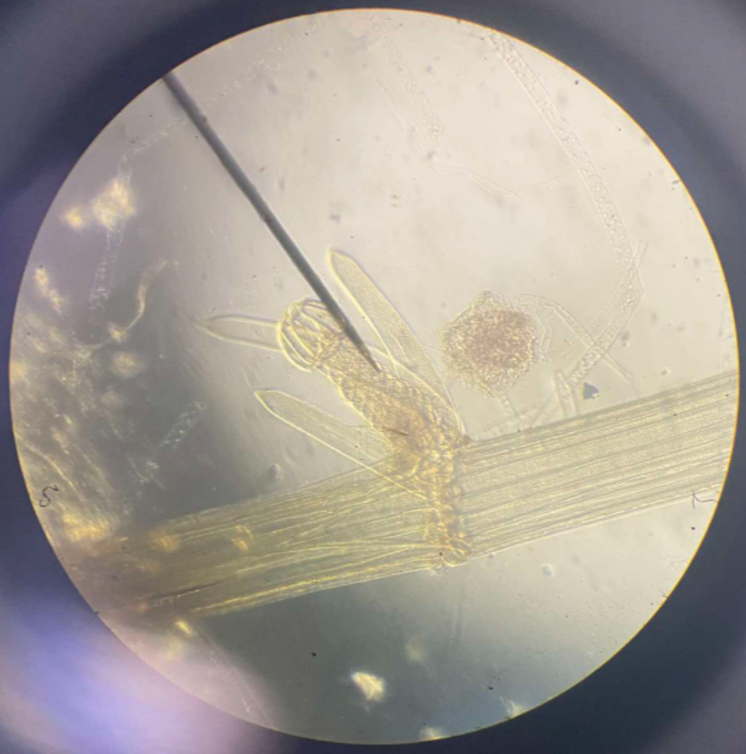 <p>Charophytic Chlorphyta commonly found in shallow marshes and lakes; maybe more of a plant than alga; microgametangia and megagametangia</p>
