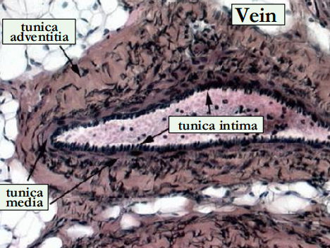 <ul><li><p>venous walls are thinner, distensible &amp; compressible</p></li><li><p>semilunar bicuspid valves keep blood moving in right direction</p></li></ul><p></p>