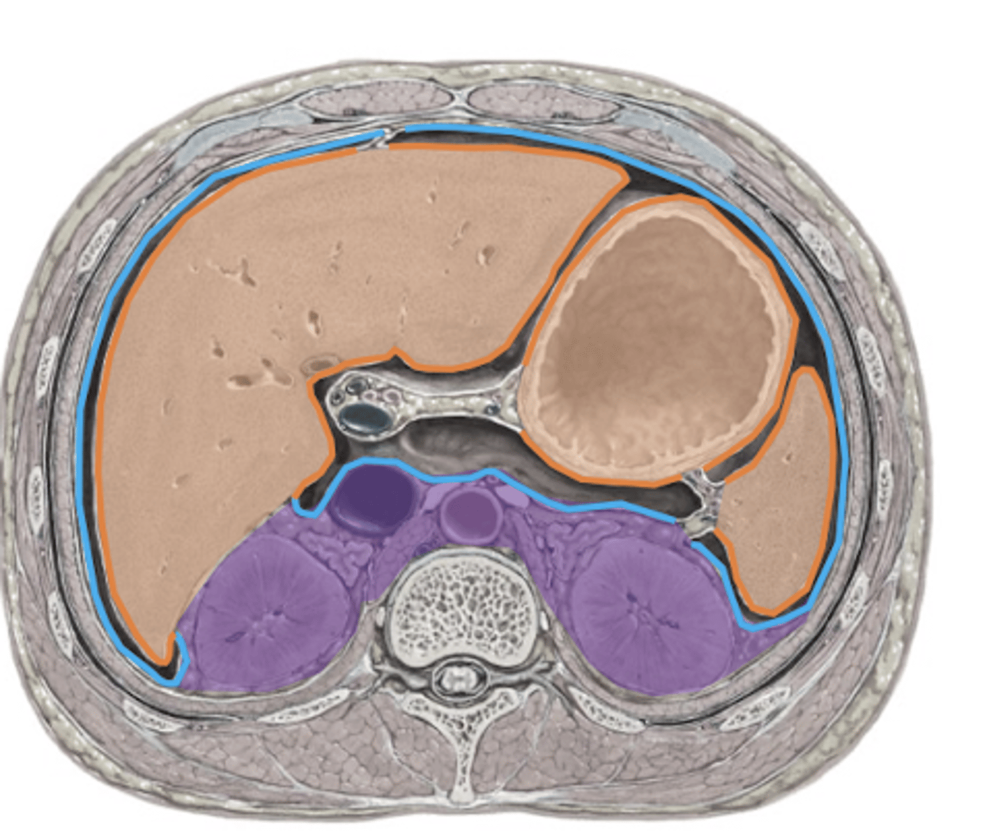 <p>-protrudes into peritoneal cavity</p><p>-walls covered by visceral peritoneum</p><p>-has a mesentery</p>
