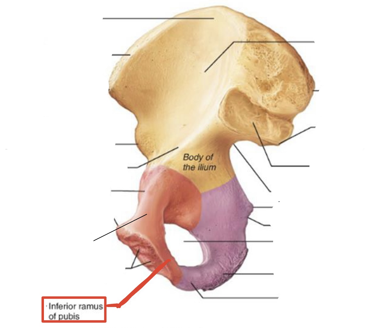 <p><span><span>Inferior pubic ramus</span></span></p>