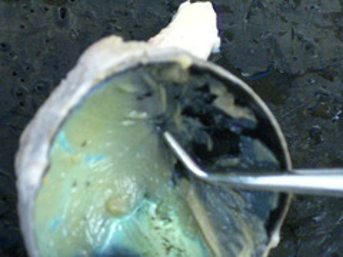 <p>places where axon exits</p>