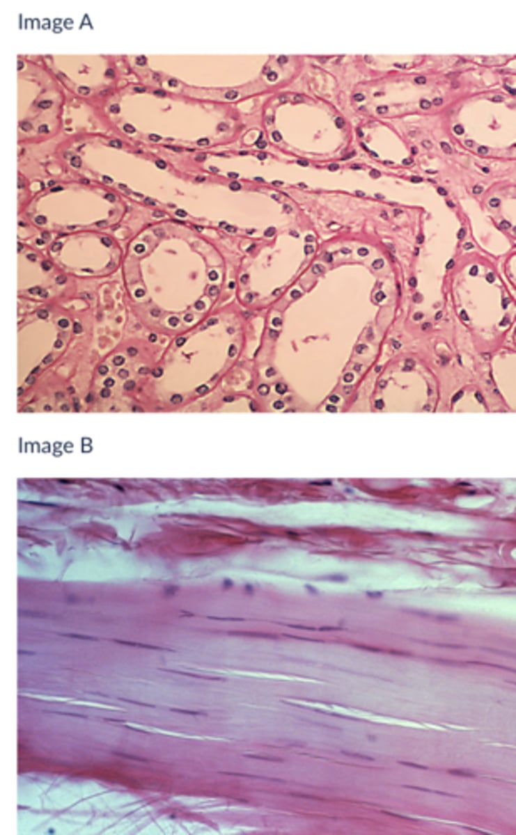 <p>Which of the following tissues is likely responsible for secretion or absorption</p><p>Image A</p><p>Image B</p><p>Neither</p><p>Both</p>