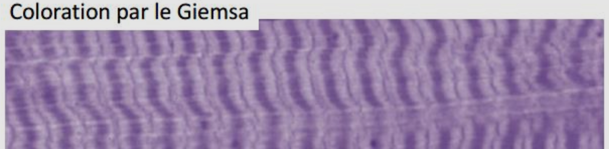 <p>Que peut on dire de la striation du muscle strié squelettique observable en microscopie </p>