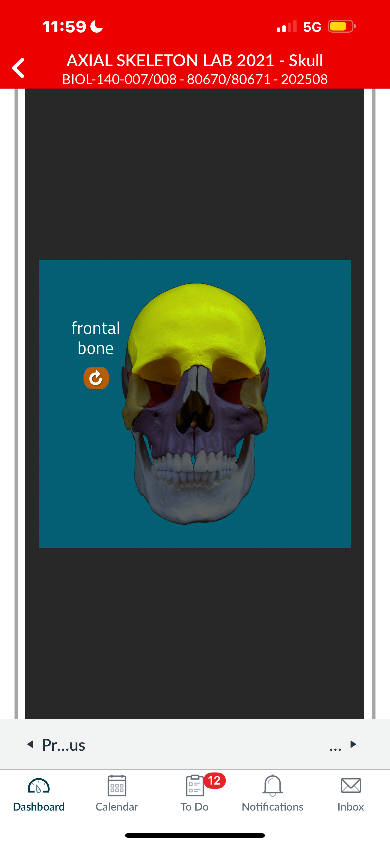 <p>Frontal bone</p>