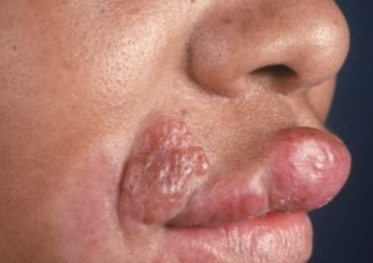 <p>What is the diagnosis?</p>
