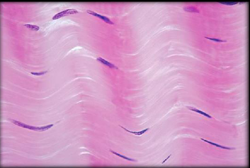 <p>CT Type: CT Proper</p><p>Fibers: Collagen fibers tightly packed together</p><p>Function: Withstand force in one direction - resist stress</p><p>Location: In tendons and some ligaments</p><p>Characteristics: Parallel collagen fibers in one direction and compressed fibroblast nuclei</p>