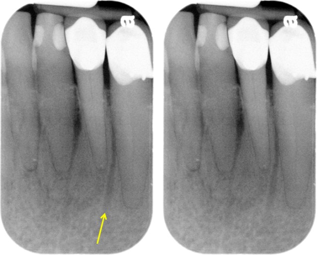 <p>Nutrient canals</p>