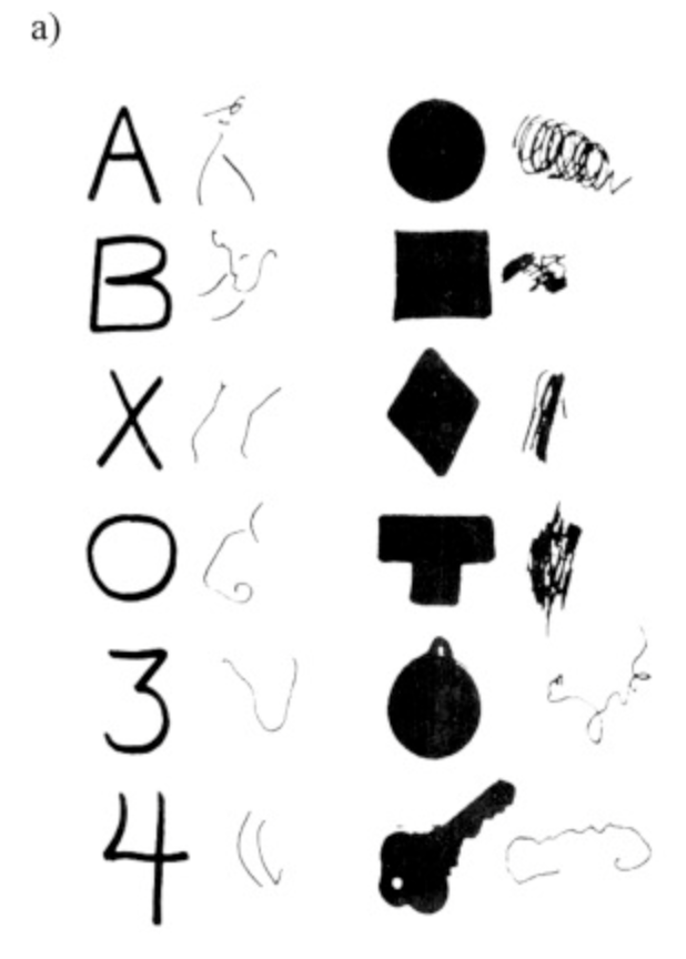 <p>failures in recognition due to failures in perception - able to locate the stimulus and recognize its parts, but unable to group them together and identify what it is</p><ul><li><p>can describe objects</p></li><li><p>can write, but don’t understand what they are being told to write</p></li><li><p>can recognize objects when touching them or using other modalities that are not visual</p></li><li><p>damage to occipital lobe and occipitotemporal pathway</p></li><li><p>more severe than associative agnosia</p></li><li><p>affects ventral pathway</p></li></ul><p></p>