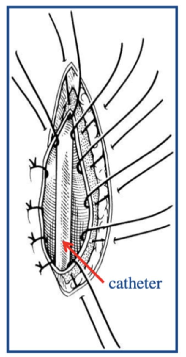 <p>What is this the closure for?</p>