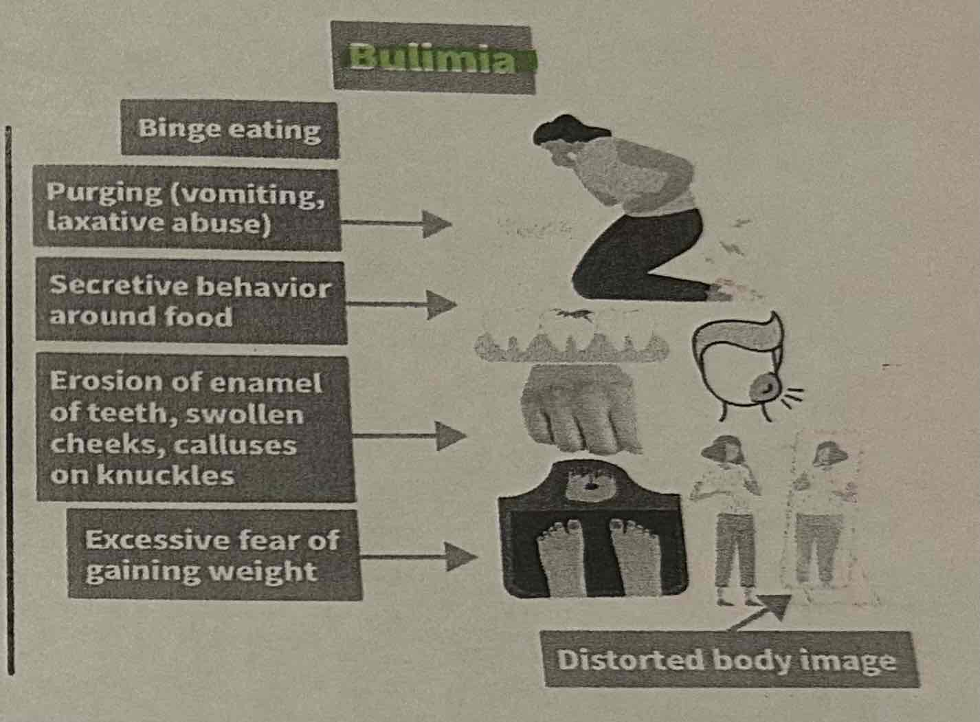 <p><span>﻿﻿Signs of bulimia:</span></p><ul><li><p><span>﻿﻿Binge eating</span></p></li><li><p><span>﻿﻿Purging (such as self-induced vomiting, laxative abuse, or excessive exercise)</span></p></li><li><p><span>﻿﻿Extreme fear of weight gain</span></p></li><li><p><span>﻿﻿Distorted body image</span></p></li><li><p><span>﻿﻿Secretive behavior around food</span></p></li><li><p><span>﻿﻿Swollen cheeks or calluses on knuckles from self-induced vomiting</span></p></li><li><p><span>﻿﻿Erosion of enamel of teeth</span></p></li></ul>